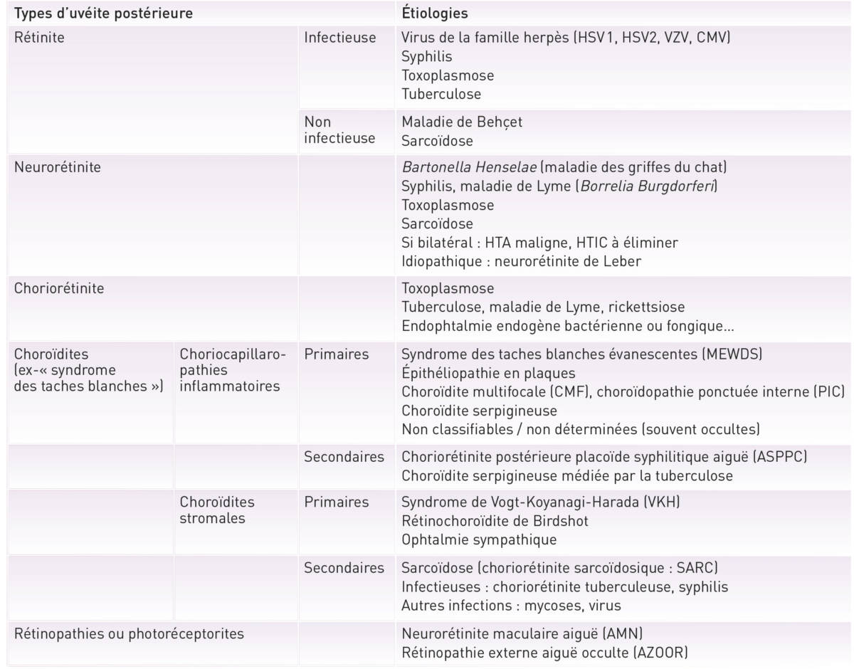 Tableau. Principaux aspects d’une uvéite postérieure et leurs étiologies les plus fréquentes.