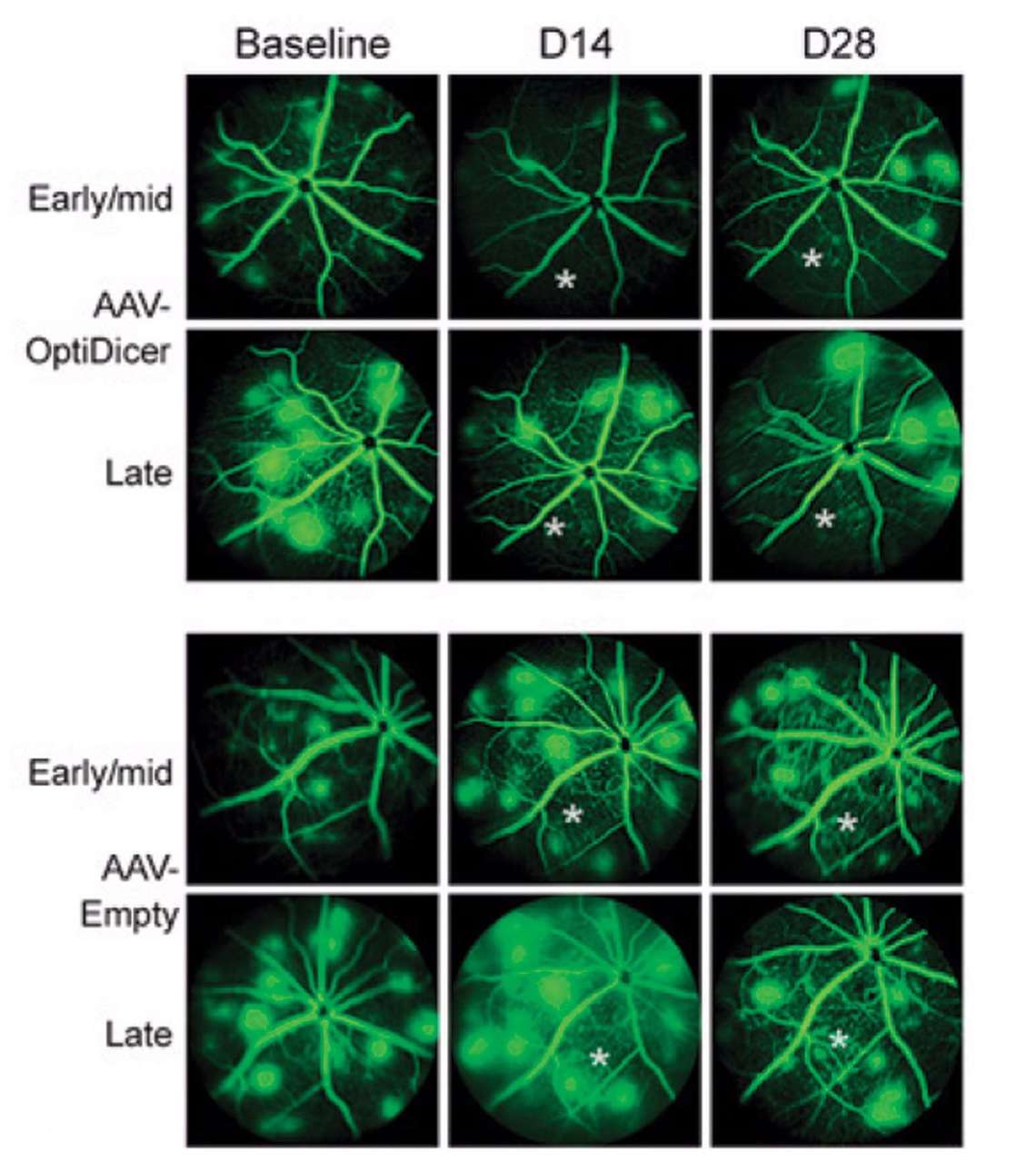 Les angiogrammes à la fluorescéine des souris JR5558 (modèles pour la néovascularisation choroïdienne spontanée) montrent l’effet du vecteur de thérapie génique AAV-OptiDiver par rapport au contrôle AAV-Empty. Les angiographies ont été réalisées avant l’injection sous-rétinienne ainsi que 14 et 28 jours après. Le site approximatif de l’injection est marqué par un astérisque.