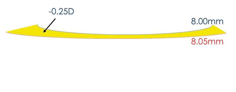 Figure 7. Si la lentille est plus plate que la cornée, un ménisque divergent se forme et entraîne un effet optique de 0,25 D par 0,05 mm de différence de rayon.