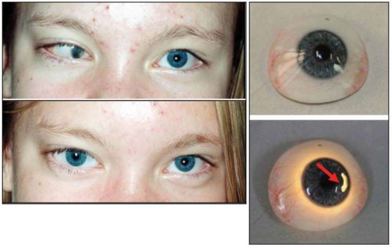 Figure 11