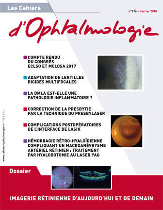 N°216 - Février 2018