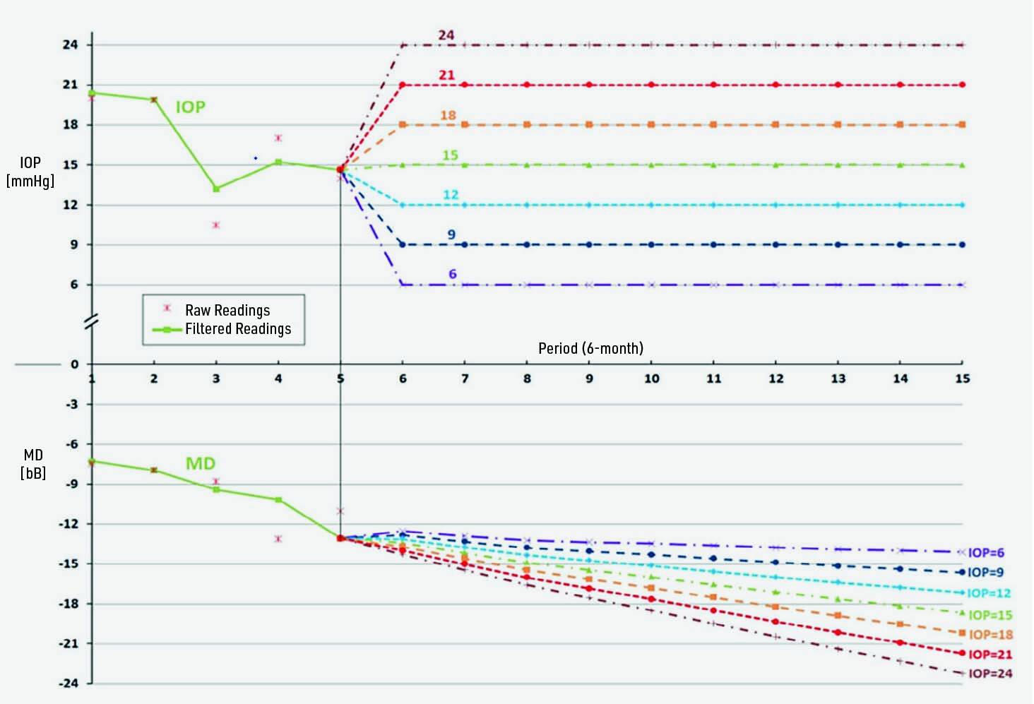 Figure 2. Exemples de prévisions de la vitesse de progression d’un glaucome en fonction des valeurs futures de la PIO[3].
