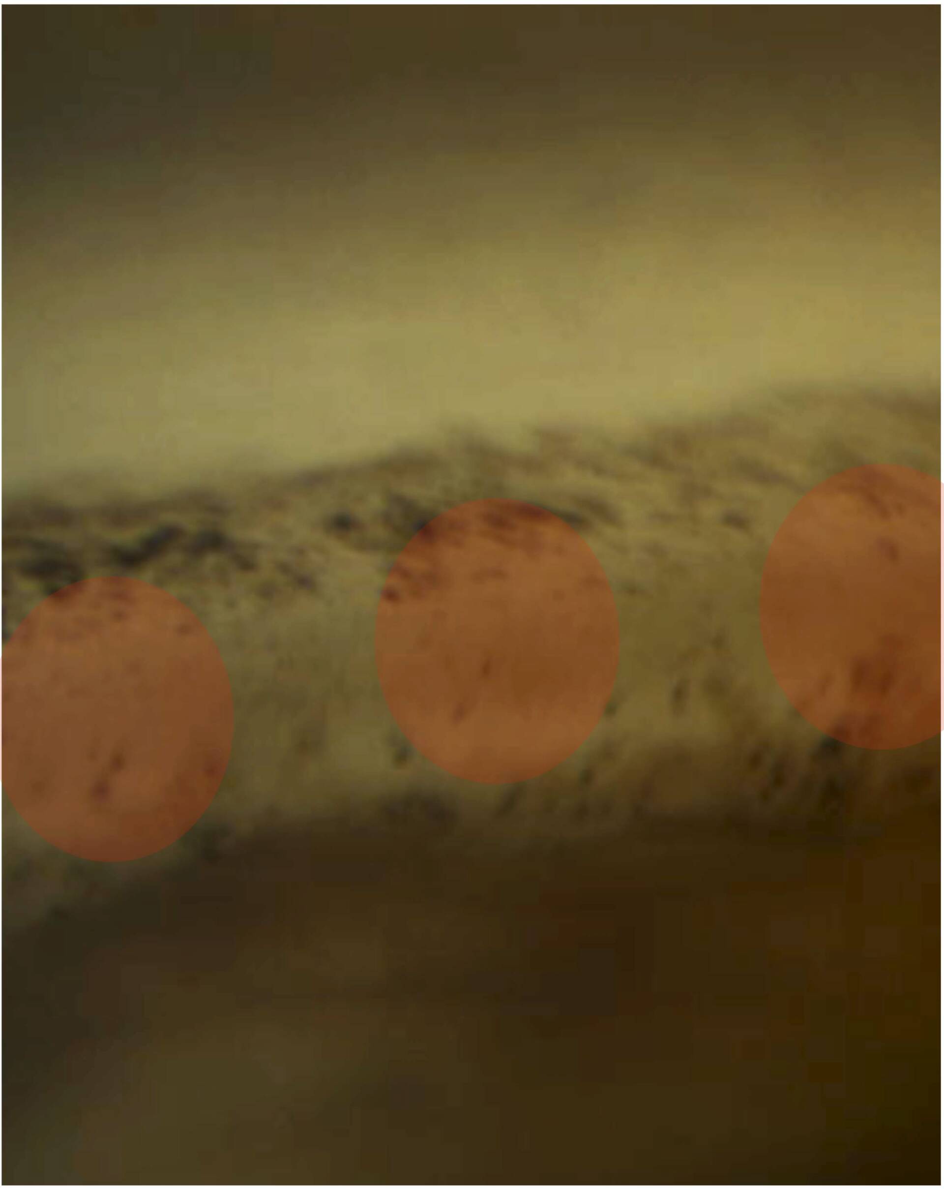 Figure 3. Localisation du spot de laser SLT dans la fenêtre trabéculaire : ce dernier est centré à cheval sur le trabéculum pigmenté.

