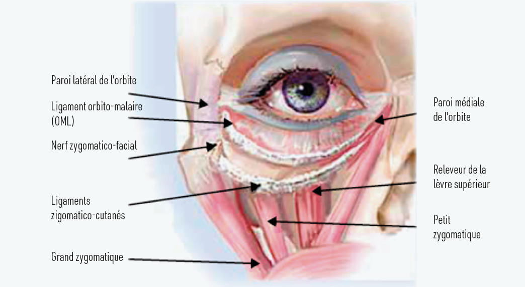 Figure 2. Anatomie de la région palpébro-malaire.
