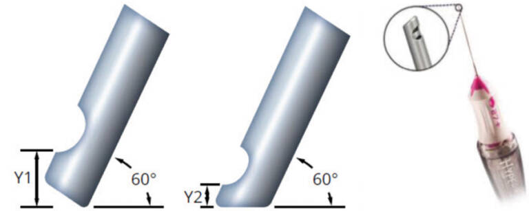 Figure 3. Comparaison sonde Alcon standard et Hypervit biseautée (source : laboratoire Alcon).
