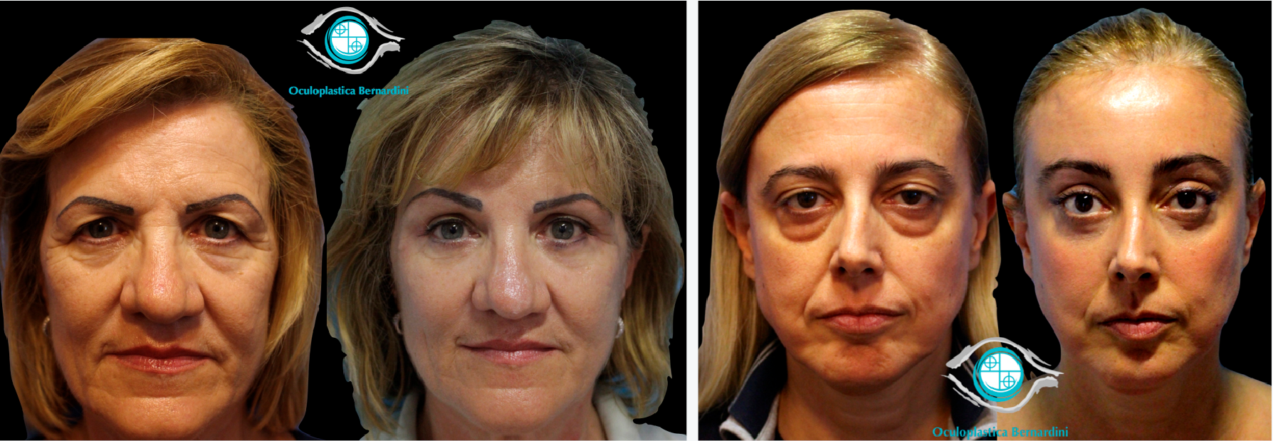 Figure 8. Résultats.
