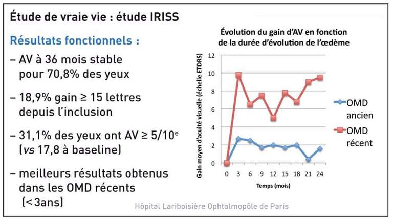 Figure 3. Étude de vraie vie : étude IRISS [3].
