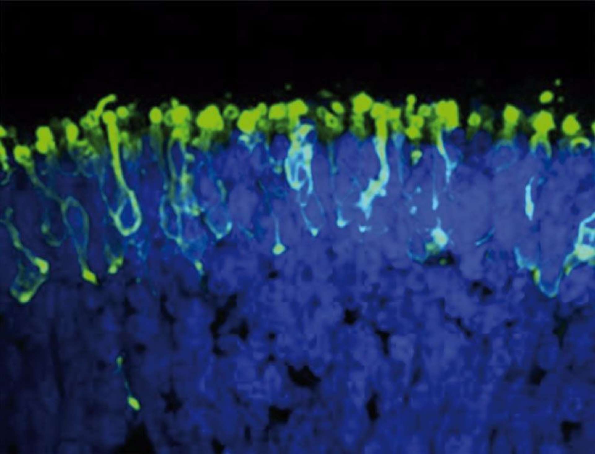 Bâtonnets (en vert) au sein d’une rétine dérivée de cellules pluripotentes induites, in vitro (John Hopkins Medicine).
