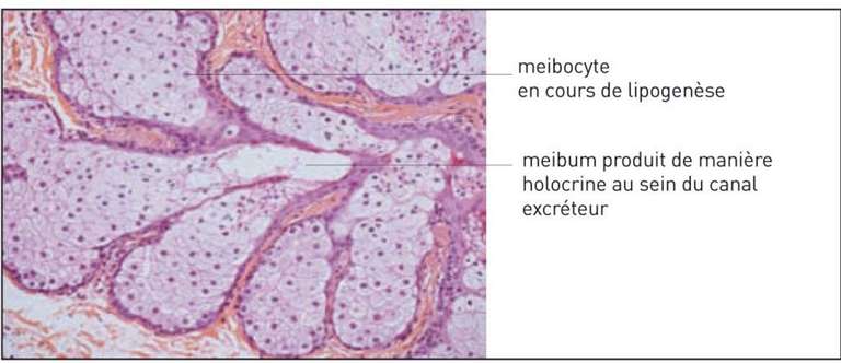 Figure 1. Coupe histologique après coloration HES grossissement x 20 montrant les glandes de Meibomius composées de meibocytes regroupés en acini (Léger F, Morice C).&nbsp;

