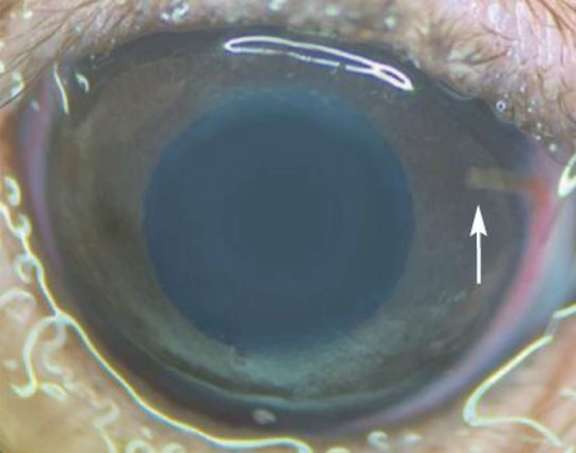 Image d’un œil de rat implanté avec une canule
