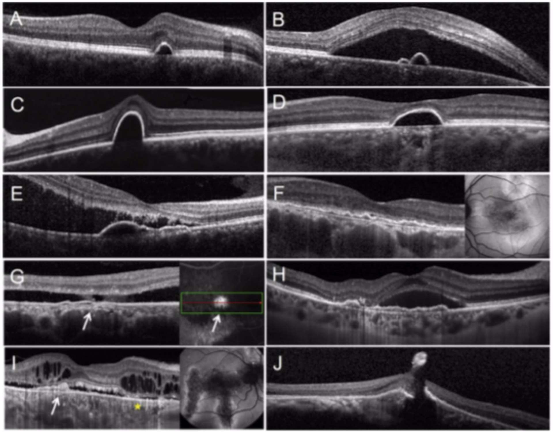 Figure 2.  [2].
