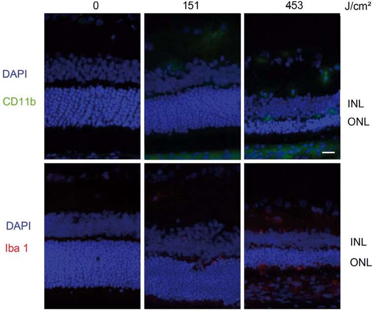 Figure 2. Réponse inflammatoire après exposition à des LED blanches [1]. Rats mâles âgés de 7 semaines exposés à des LED Xanlite XXX Evolution 5 W pendant 1 et 3 jours, recevant la dose rétinienne estimée de lumière indiquée. À la fin de la période d’exposition, les yeux sont prélevés et analysés après immunomarquage (anti-CD11b [vert], anti-Iba 1 [red] ; et DAPI [blue]). ONL : Outer Nuclear Layer; INL: Inner Nuclear Layer. La barre d’échelle représente 20 mm. La coloration Iba1 (rouge) montre l’activation microgliale et macrophagique induite par l’exposition à la lumière.&nbsp;
