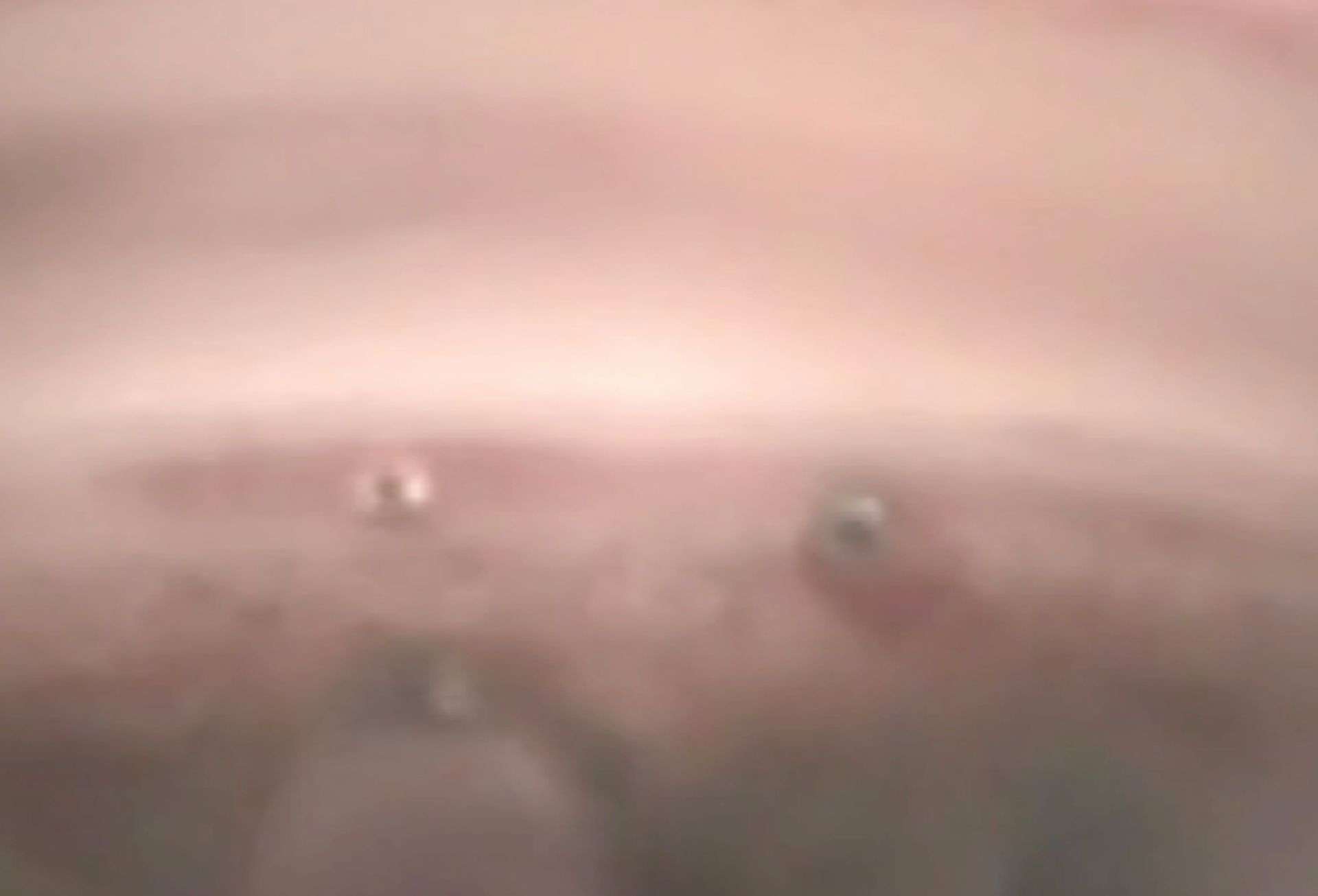 Figure 1. A. Aspect peropératoire d’un drain ab interno (iStent Inject, Glaukos, États-Unis) inséré dans le trabéculum.
