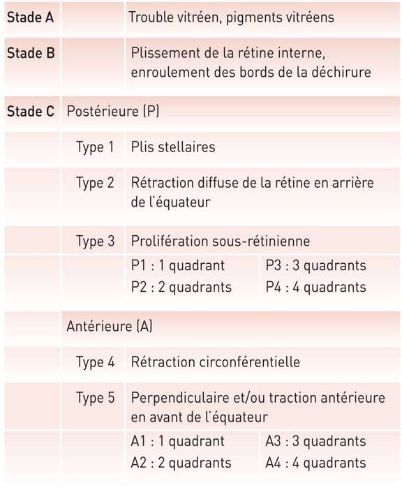 Tableau. Stades de la prolifération vitréo-rétinienne selon la classification modifiée de la Retina Society.
