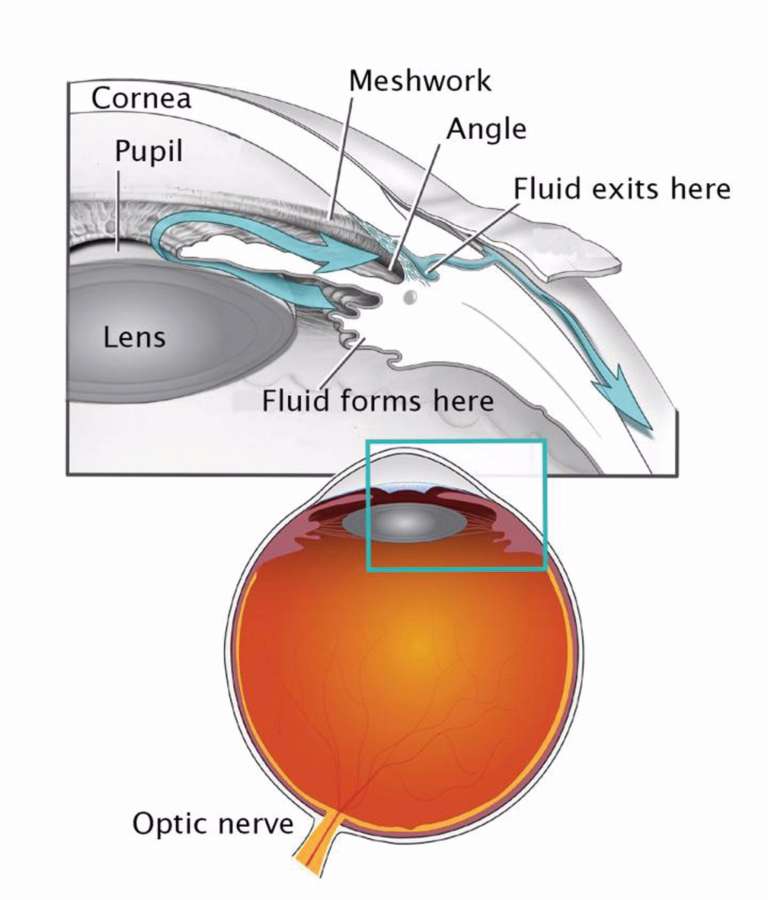 Le trabéculum et l’angle irido-cornéen sont des structures qui permettent à l’humeur aqueuse de sortir de l’œil. Les chercheurs supposent que la chirurgie de la cataracte interfère avec la maturation de ce système de drainage, menant à une augmentation de la PIO et endommageant l’œil de l’enfant. Crédit : National Eye Institute
