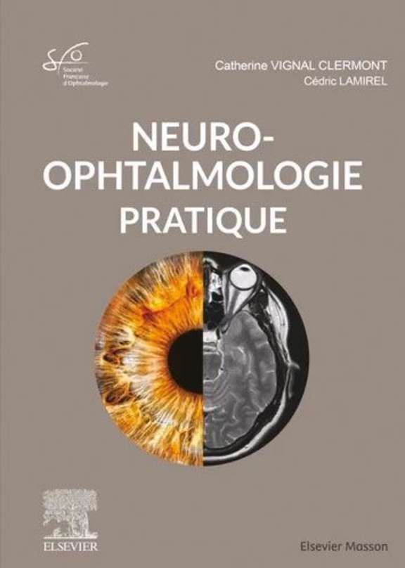 Neuro-ophtalmologie pratique Rapport SFO 2020, Catherine Vignal-Clermont, Cédric Lamirel Elsevier-Masson, mai 2021, 504 pages, 285 e. ISBN : 9782294763830
